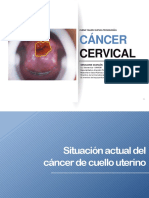 Situación Actual Del Cáncer de Cuello Uterino PDF