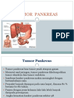 Cara Mencegah Kanker Pankreas