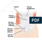 Hernias y Su Localizacion y Sus Nombres