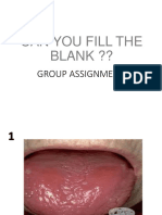Can You Fill The Blank ??: Group Assignment