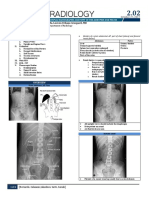 Normal Abdominal X-Ray Findings