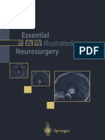Essential Illustrated Neurosurgery
