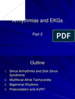 Arrythmias and EKGs 2