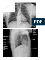 CXR