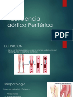 Enfermedad Vascular Periferica