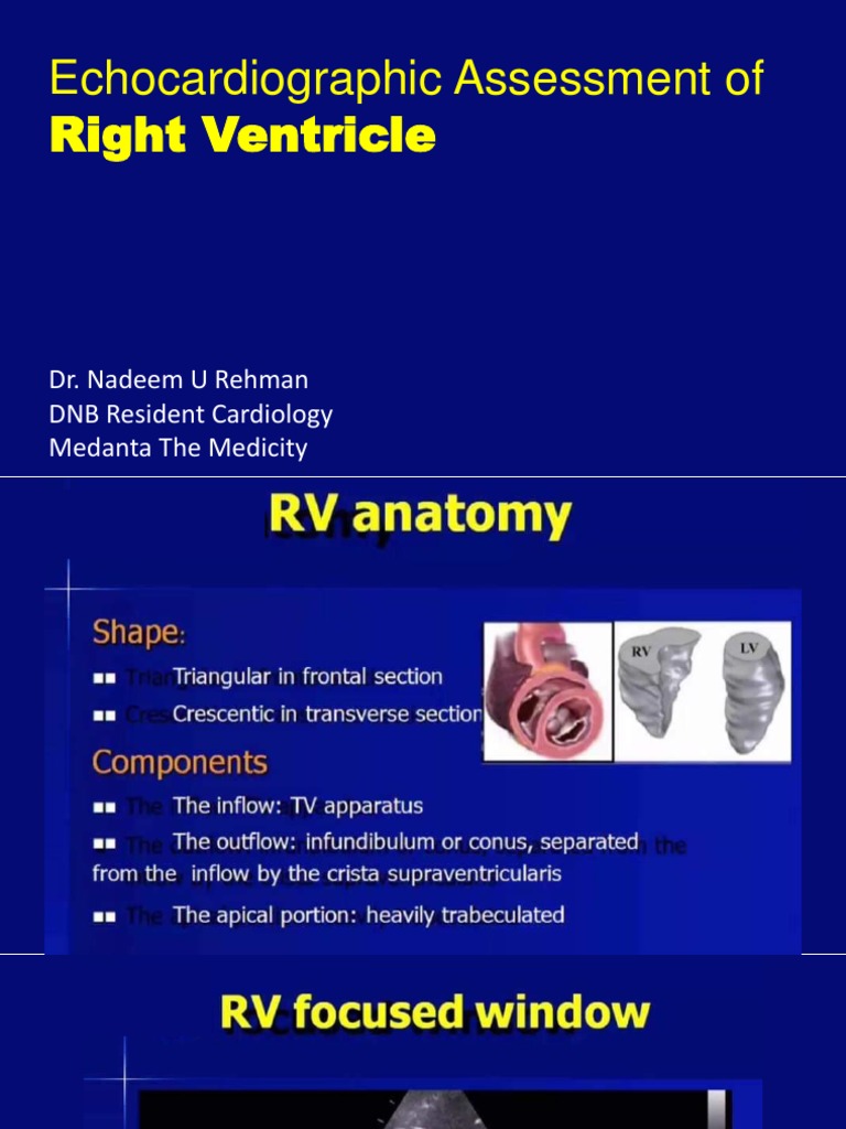 Echocardiographic Assessment Of: Right Ventricle | PDF
