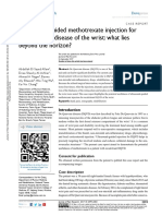 JPR 143256 Ultrasound Guided Methotrexate Injection For de Quervain Dis 092617