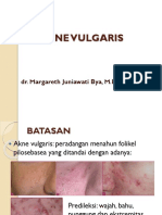 Acne Vulgaris