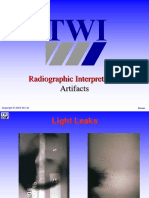 Radiographic Interpretation: Artifacts