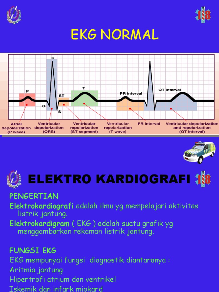 Unduh 420 Koleksi Gambar Ekg Normal Dan Tidak Normal  