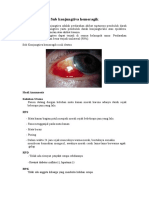 Perdarahan Subkonjungtiva Adalah Perdarahan 1t