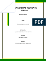 Electrocardiogram A