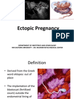 Ectopic Pregnancy Diagnosis and Treatment