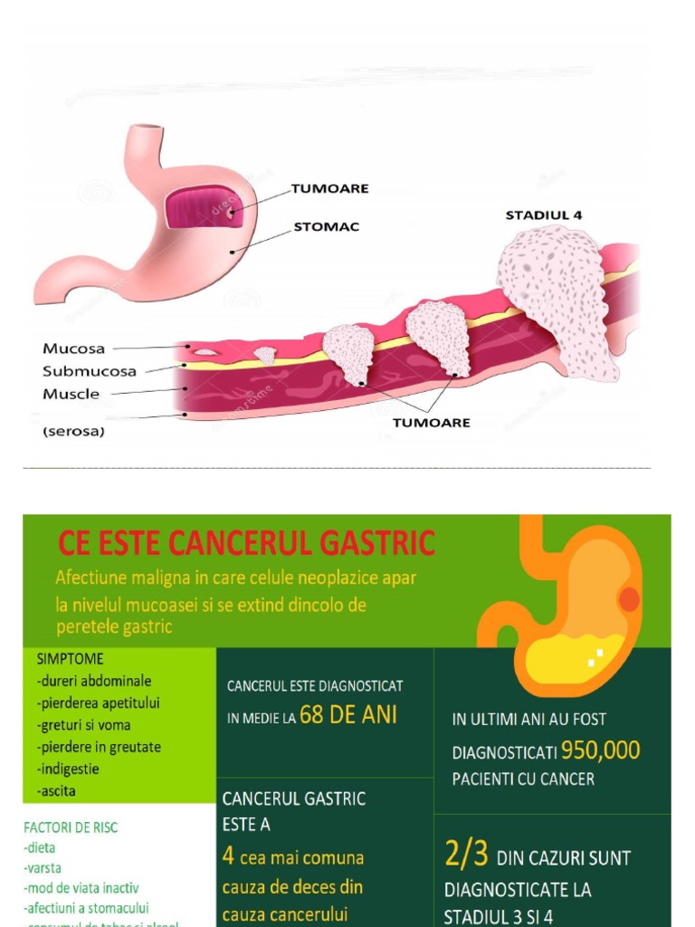 cancer gastric stadiul 1