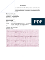 Tutorial Skenario Atrial Fibrilasi