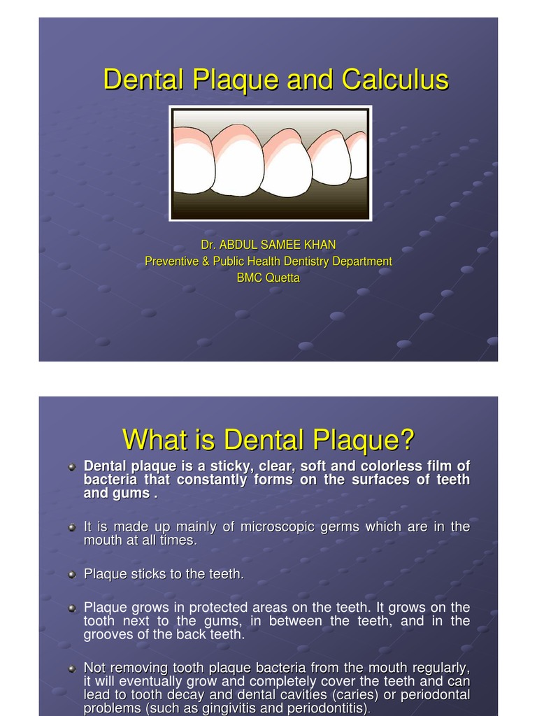 Dental Plaque and Calculus Human Tooth Dentistry