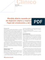 Mordida Abierta Causada Por Hábitos de Deglución Atípica y Respiracion Bucal. Papel Del Ortodoncista y Del Logopeda PDF