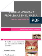 52437792 Frenillo Lingual y Problemas en El Habla