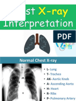 X-ray Chest Interpretations