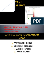 Fixxx Aritmia Yang Mengancam Jiwa