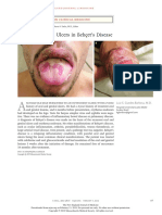 Oral and Genital Ulcers in Behçet's Disease: Images in Clinical Medicine