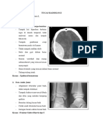 Tugas Radiologi