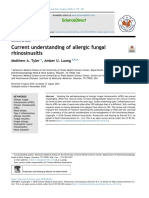 Current Understanding of Allergic Fungal Rhinosinusitis: Sciencedirect