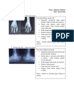 Tugas Radiologi 3 Elqa