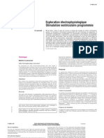 Exploration électrophysiologique - Stimulation ventriculaire