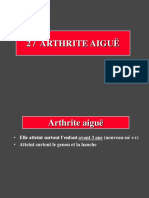 2 - Arthrite Aigue