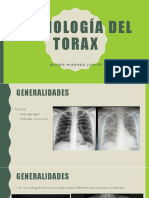 Radiología Del Torax