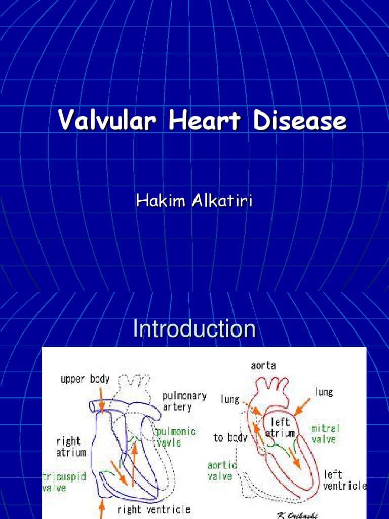 Mitral Valve Disease Overview | PDF | Heart Failure | Internal Medicine