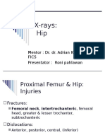 Huffman-Hip Pelvis Shoulder X-Rays