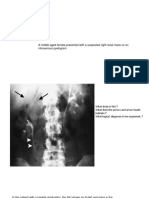 Case 1 A Middle-Aged Female Presented With A Suspected Right Renal Mass On An Intravenous Pyelogram