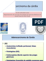 30 06 16adenocarcinoma Da Cárdia DR Elias J Ilias