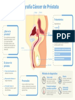 Cáncer de Próstata: Diagnóstico, Tratamientos e Infografía