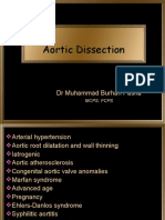 Aortic Dissection: DR Muhammad Burhan Pasha