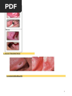 ICD 10 Codes for Oral Diseases | PDF | Human Tooth | Periodontology