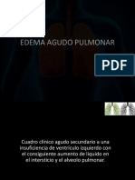 Edema Pulmonar