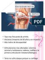 OSTEOARTROSIS