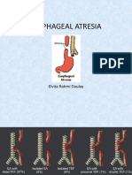 Esophageal Atresia: Elvita Rahmi Daulay