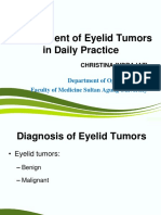 Management of Eyelid Tumors in Daily Practice: Department of Ophthalmology Faculty of Medicine Sultan Agung University