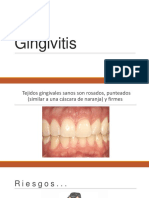 Gingivitis