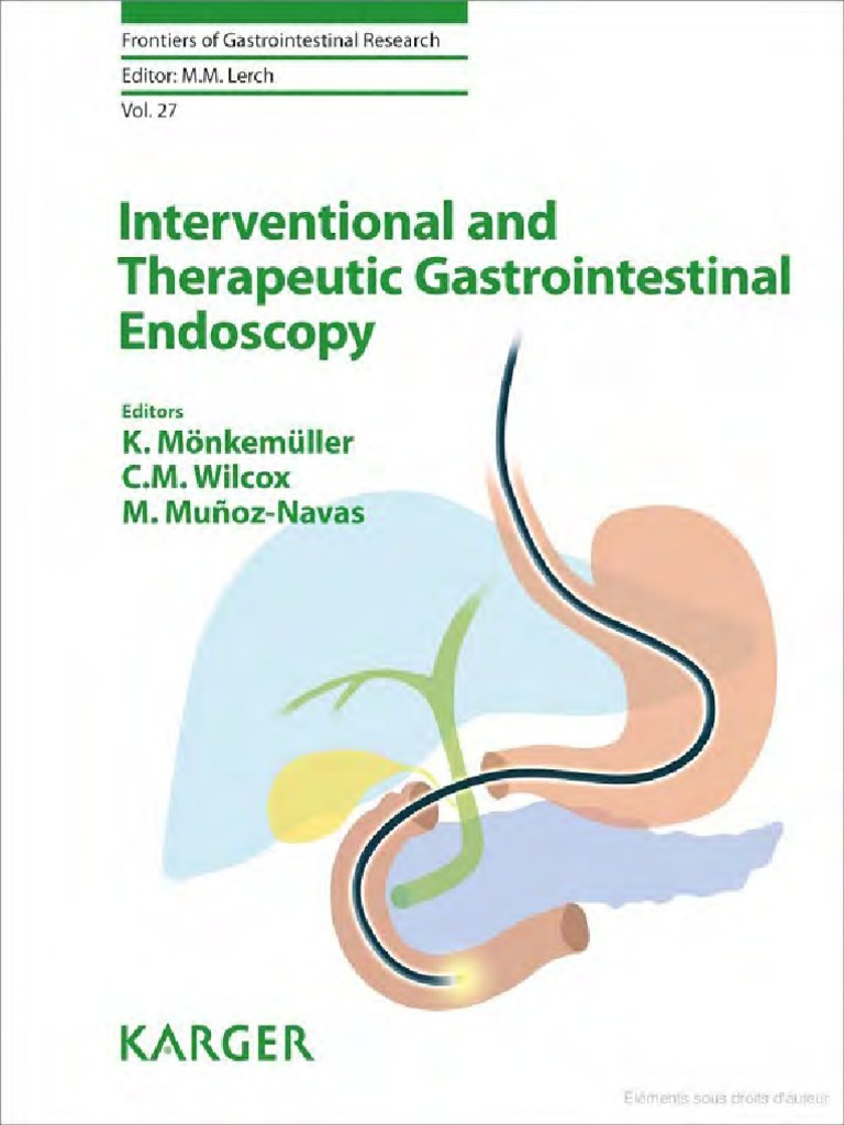 INTERVENTIONAL ENDOSCOPY.pdf Endoscopy Aspirin