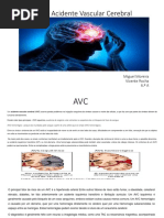 Avc