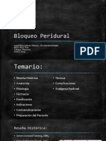 Bloqueo Peridural