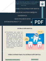 Indicaciones extracción dental