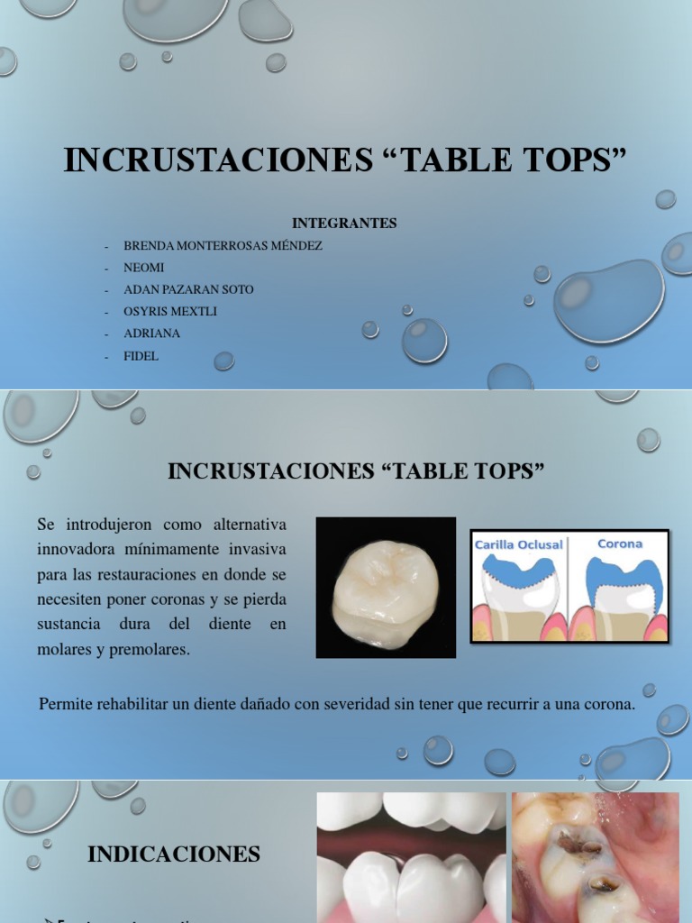 Incrustaciones Table Tops en Odontología | PDF