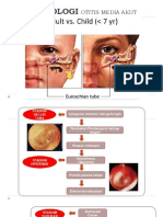 Patofisiologi Otitis Media Akut