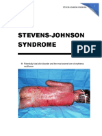 Stevens-Johnson Syndrome